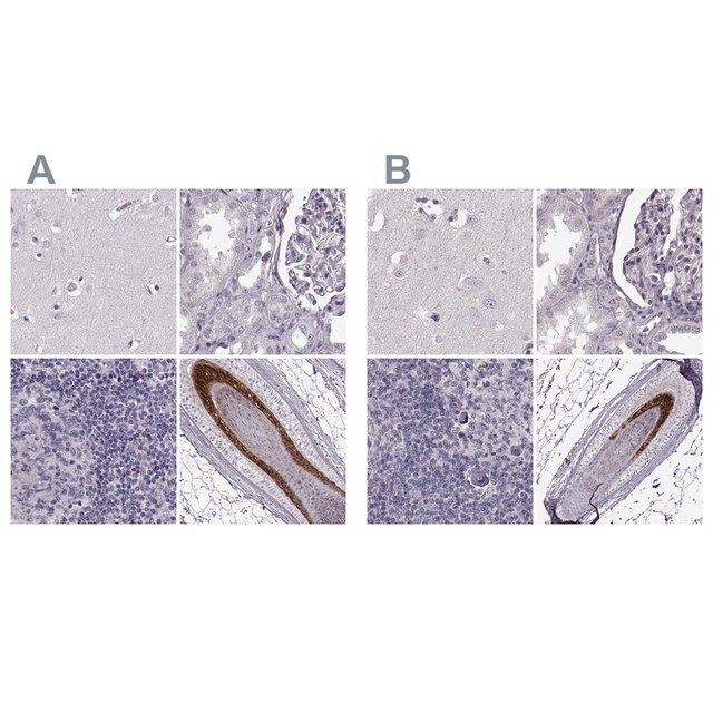 Anti-TCHHL1 antibody produced in rabbit