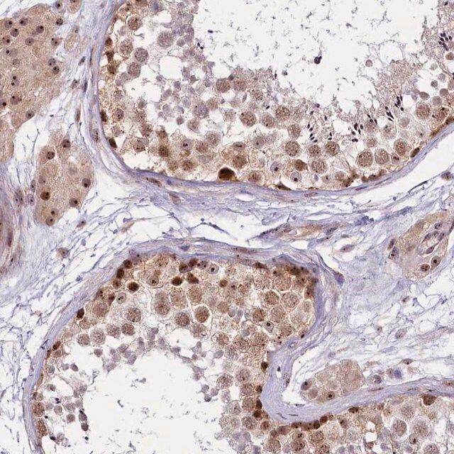 Anti-TCOF1 antibody produced in rabbit