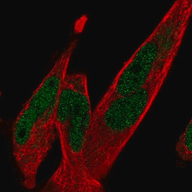 Anti-TCF7L1 antibody produced in rabbit