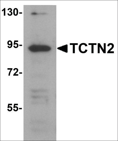 Anti-TCTN2 antibody produced in rabbit