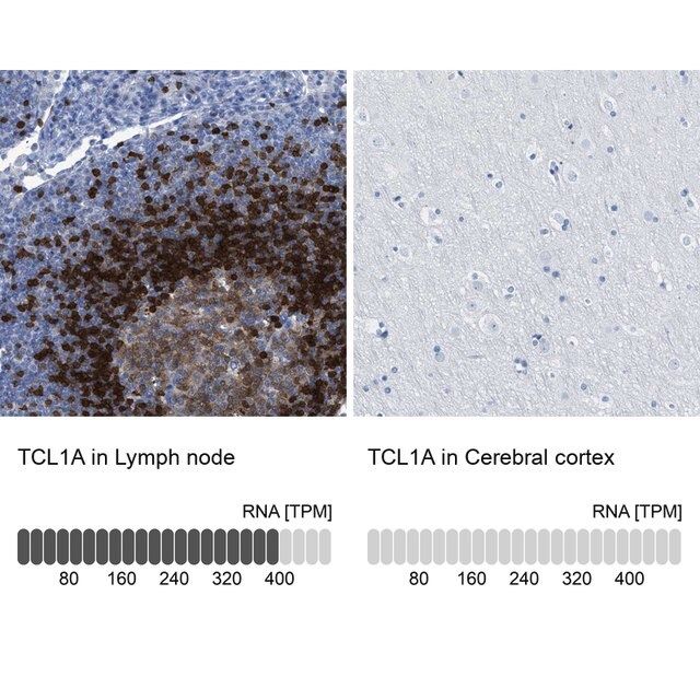 Anti-TCL1A antibody produced in rabbit
