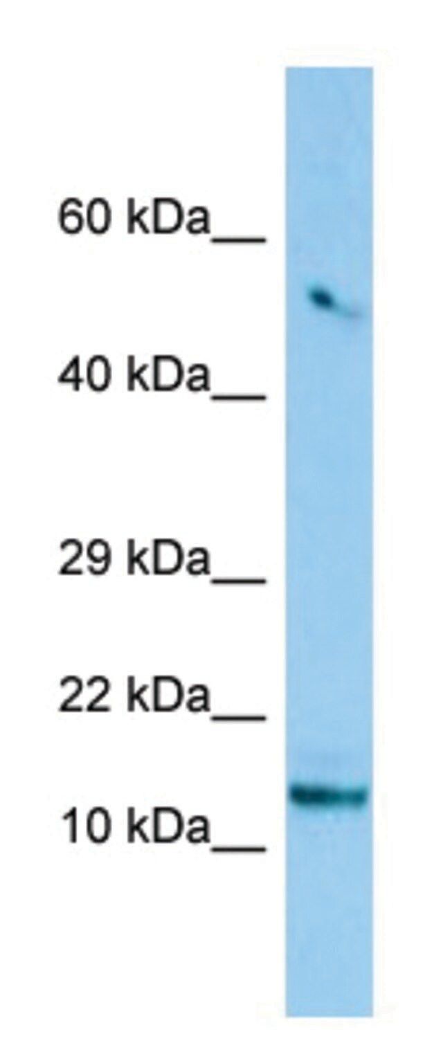 Anti-TCIM (N-terminal) antibody produced in rabbit