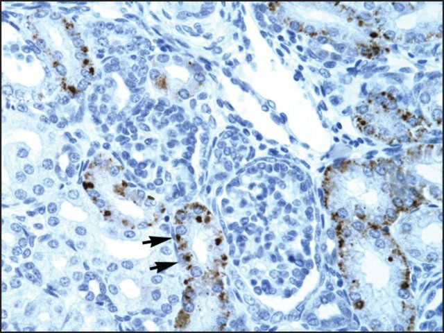Anti-TCFL5 antibody produced in rabbit