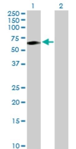 Anti-TCN1 antibody produced in rabbit