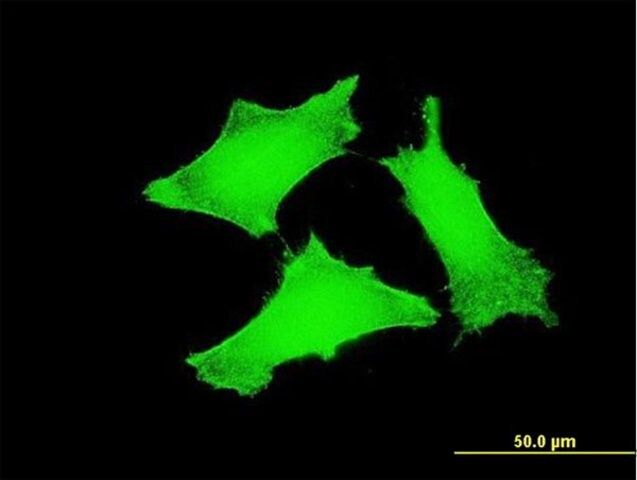 ANTI-TCL1A antibody produced in mouse