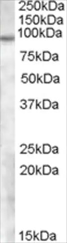Anti-TCHHL1 antibody produced in goat