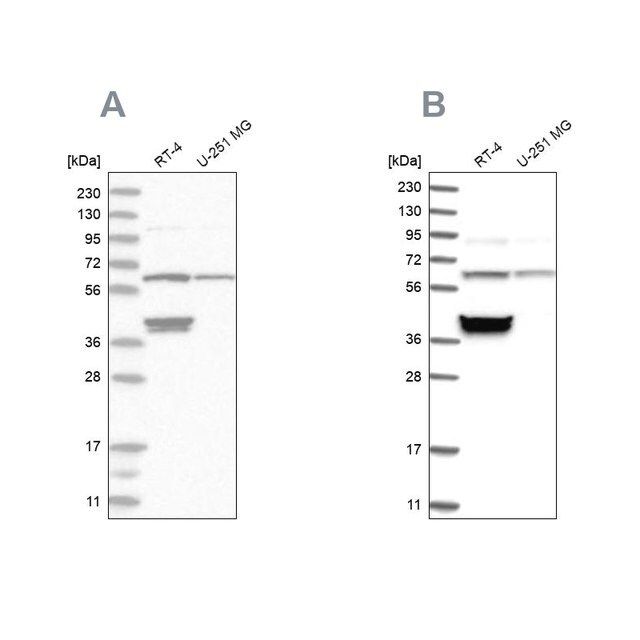 Anti-TCP1 antibody produced in rabbit