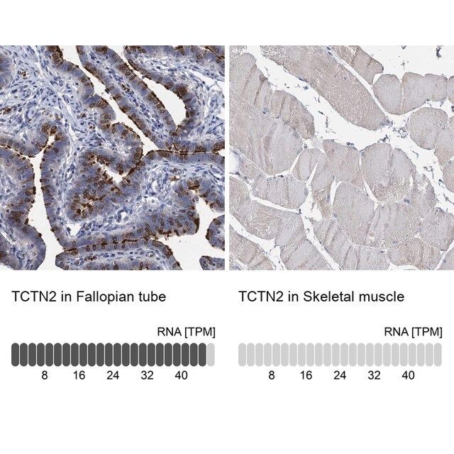 Anti-TCTN2 antibody produced in rabbit