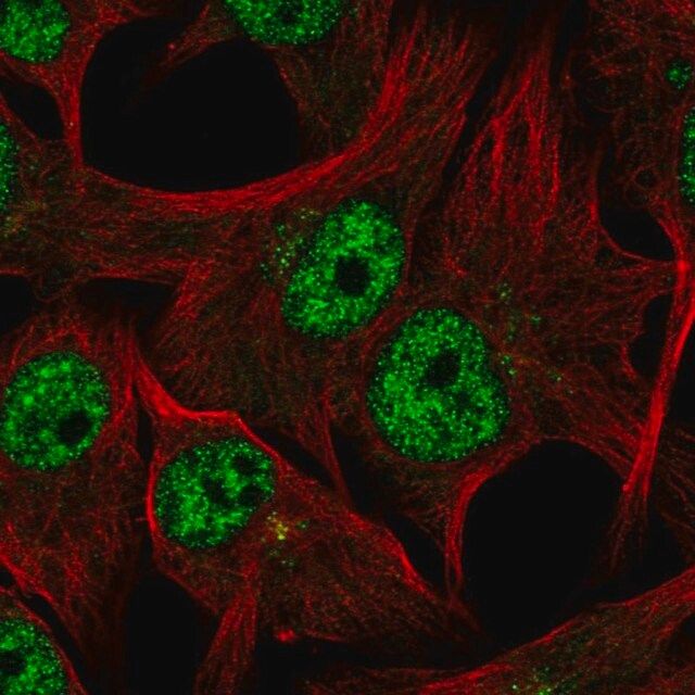Anti-TDRD3 antibody produced in rabbit