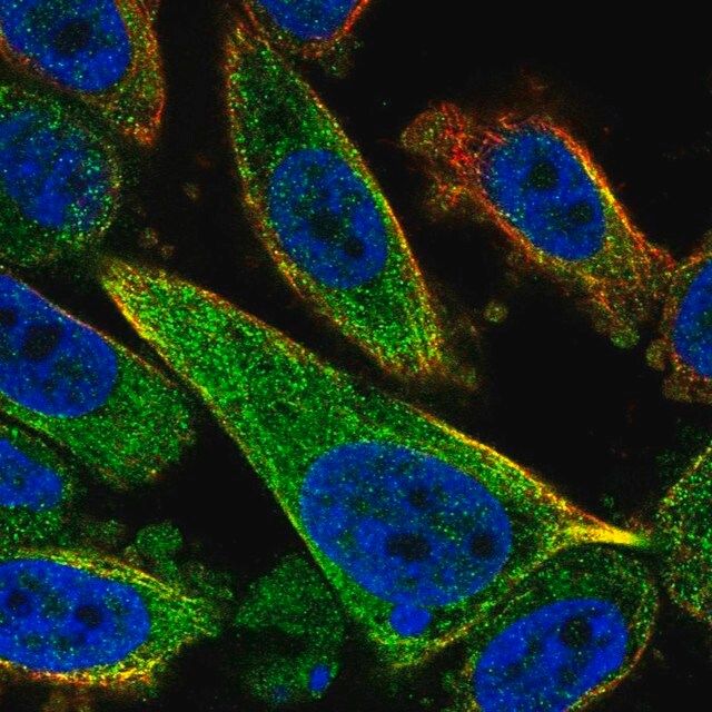 Anti-TCTEX1D2 antibody produced in rabbit
