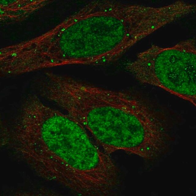Anti-TDP1 antibody produced in rabbit