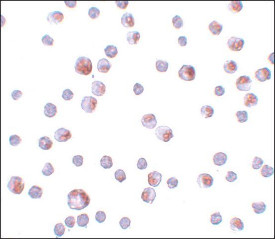 Anti-TCTN3 antibody produced in rabbit