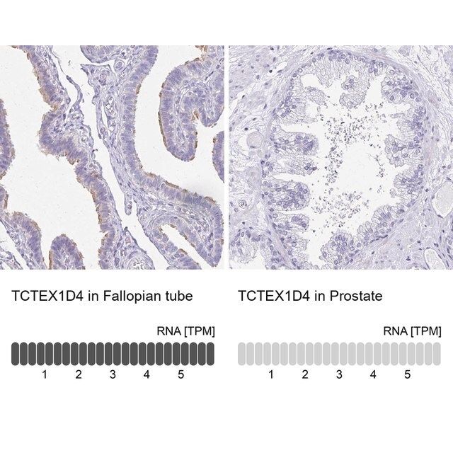 Anti-TCTEX1D4 antibody produced in rabbit