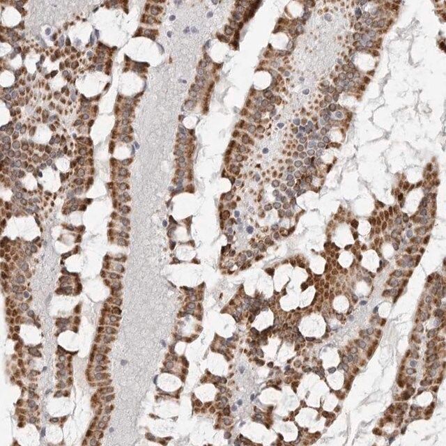 Anti-TCTN3 antibody produced in rabbit