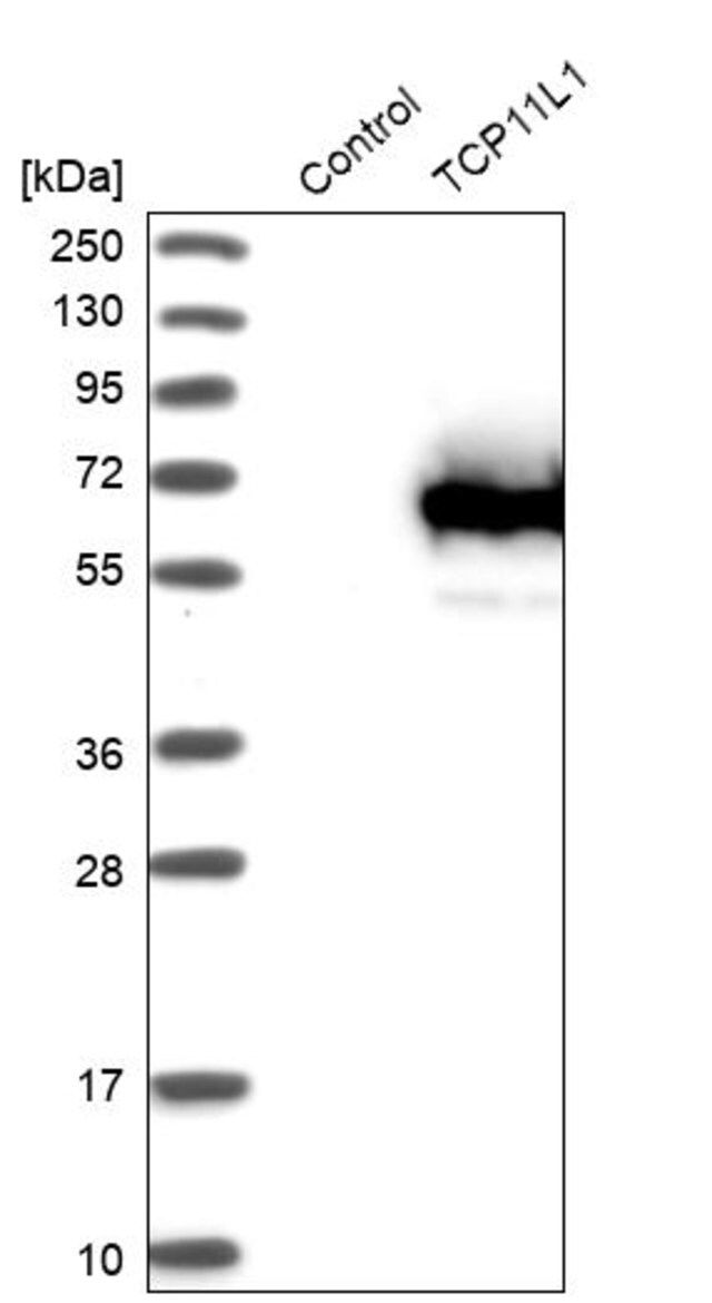 Anti-TCP11L1 antibody produced in rabbit
