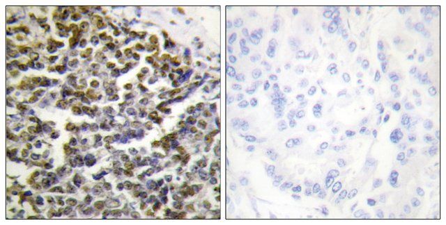 Anti-TCOF1, N-Terminal antibody produced in rabbit