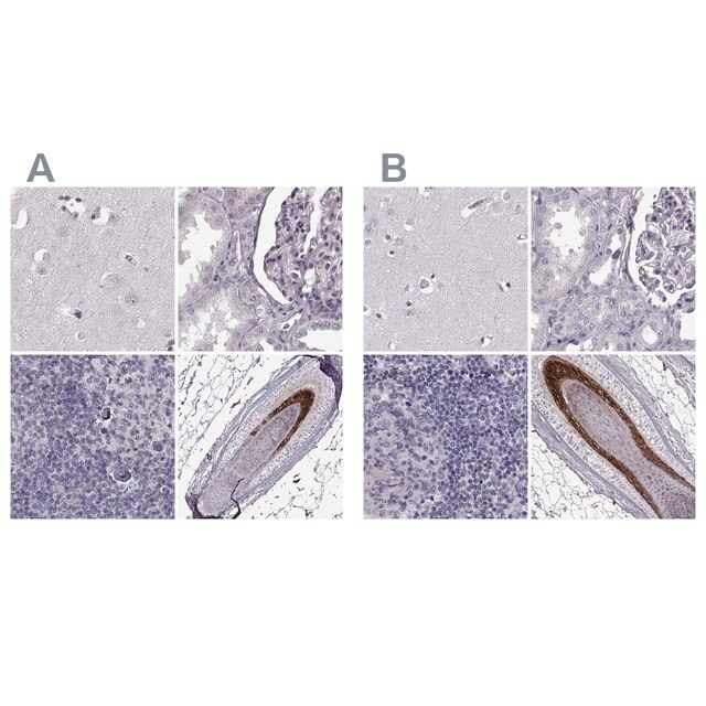 Anti-TCHHL1 antibody produced in rabbit