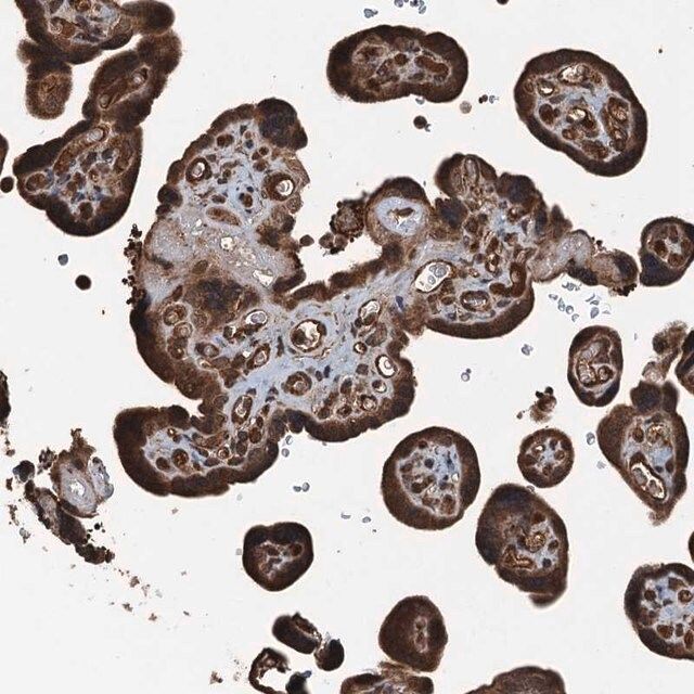 Anti-TCTN1 antibody produced in rabbit
