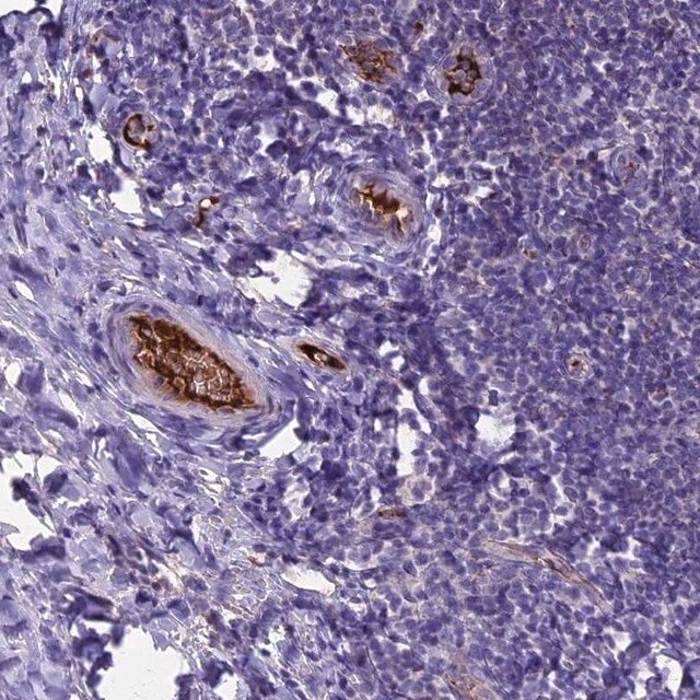Anti-TCP11L2 antibody produced in rabbit