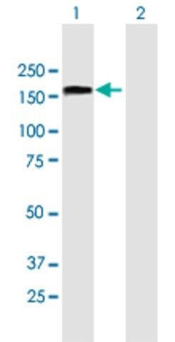 Anti-TCOF1 antibody produced in mouse