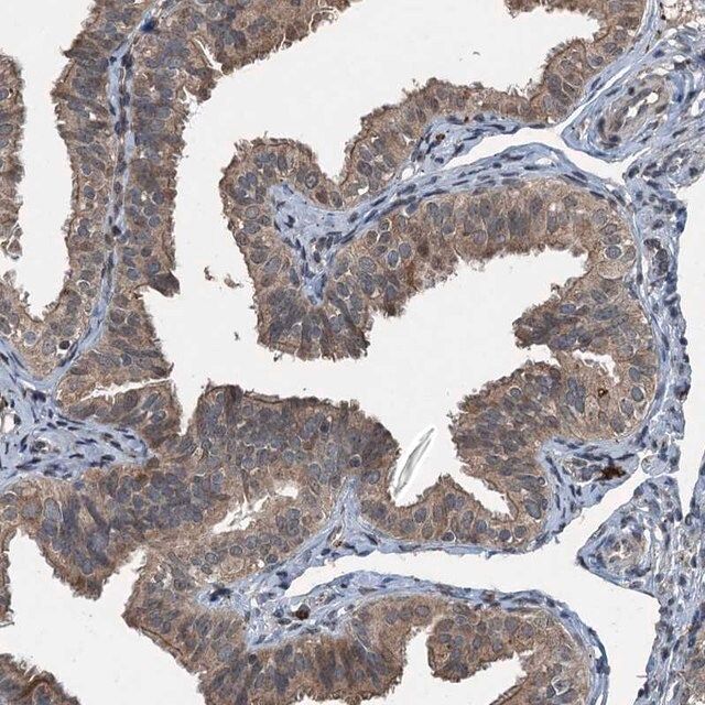 Anti-TCTN1 antibody produced in rabbit