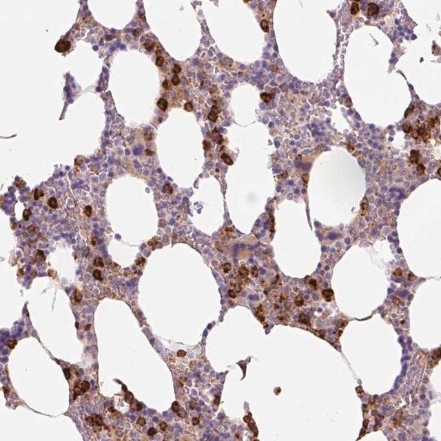 Anti-TDRD15 antibody produced in rabbit