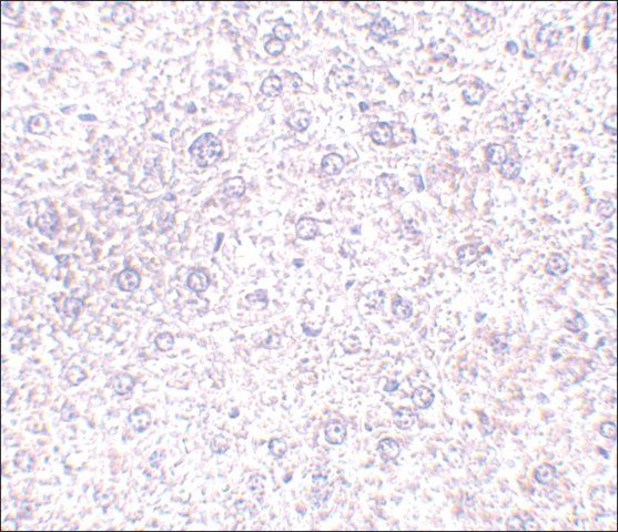 Anti-TEM7 antibody produced in rabbit