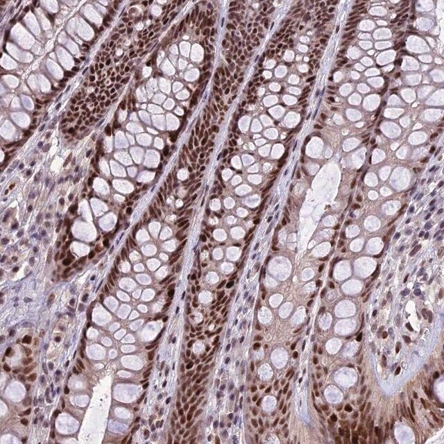 Anti-TCP11L2 antibody produced in rabbit