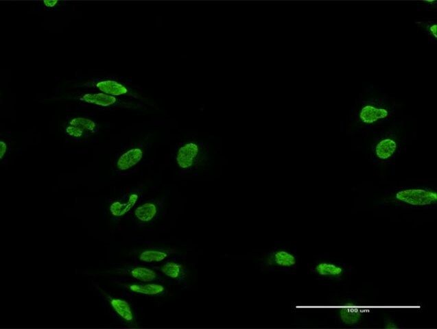 Anti-TDP1 antibody produced in rabbit