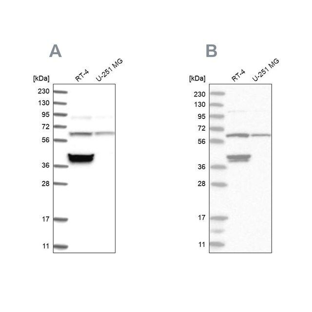 Anti-TCP1 antibody produced in rabbit