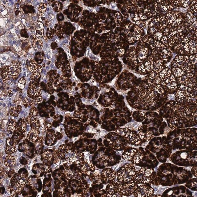 Anti-TCP10L antibody produced in rabbit