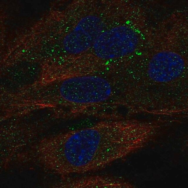 Anti-TDRD10 antibody produced in rabbit