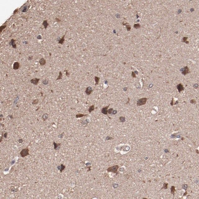 Anti-TENM1 antibody produced in rabbit
