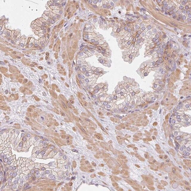 Anti-SULF1 antibody produced in rabbit