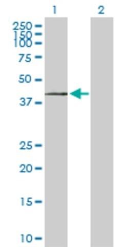 Anti-ST3GAL1 antibody produced in rabbit