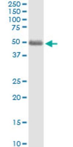 Anti-ST3GAL2 antibody produced in rabbit