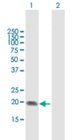 Anti-ST6GAL1 antibody produced in mouse
