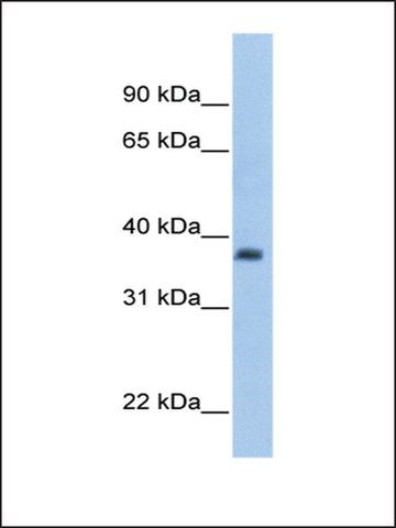 Anti-ST3GAL2 antibody produced in rabbit