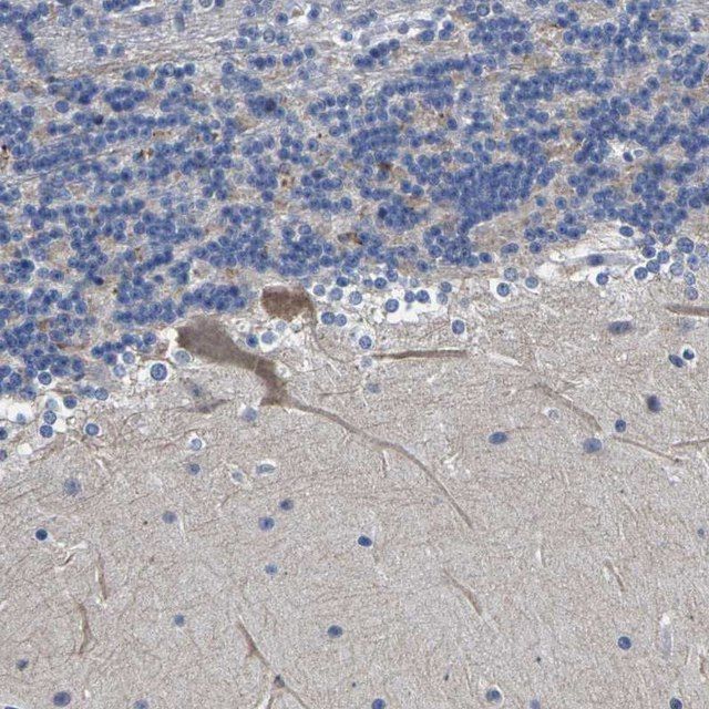 Anti-ST6GAL2 antibody produced in rabbit