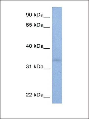Anti-ST6GALNAC3 antibody produced in rabbit