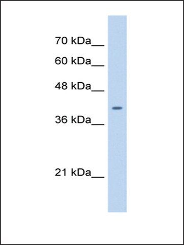 Anti-ST6GALNAC6 antibody produced in rabbit