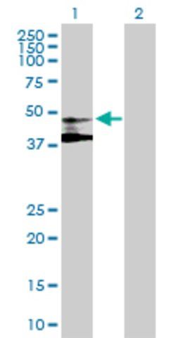 Anti-ST3GAL3 antibody produced in mouse