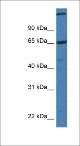 Anti-ST6GALNAC1 antibody produced in rabbit