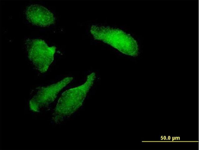Anti-STK11 antibody produced in mouse