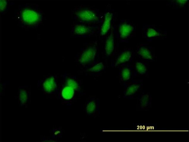 Anti-STK3 antibody produced in mouse