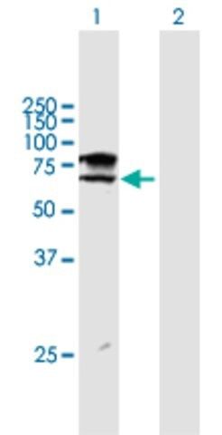 ANTI-ST6GALNAC1 antibody produced in mouse