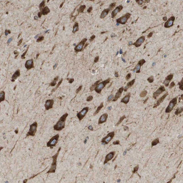 Anti-ST3GAL2 antibody produced in rabbit