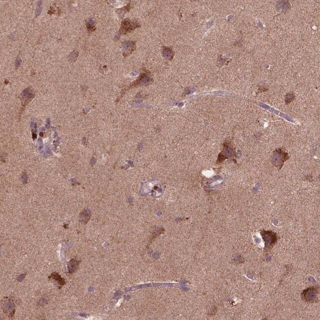 Anti-ST6GALNAC5 antibody produced in rabbit
