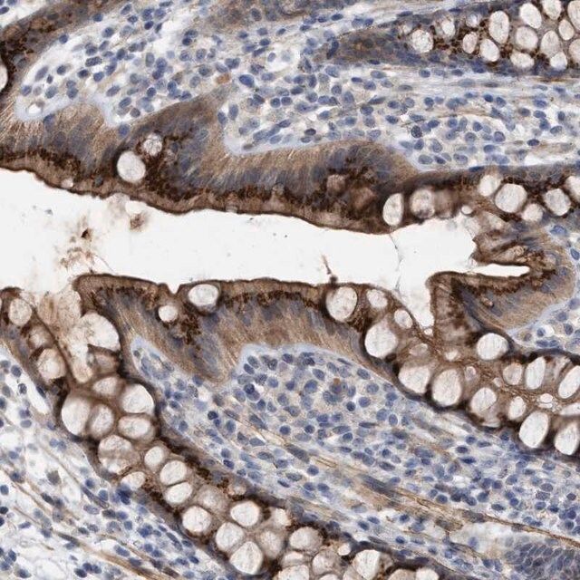 Anti-ST6GALNAC6 antibody produced in rabbit