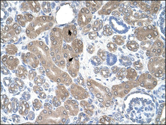 Anti-ST3GAL5 antibody produced in rabbit